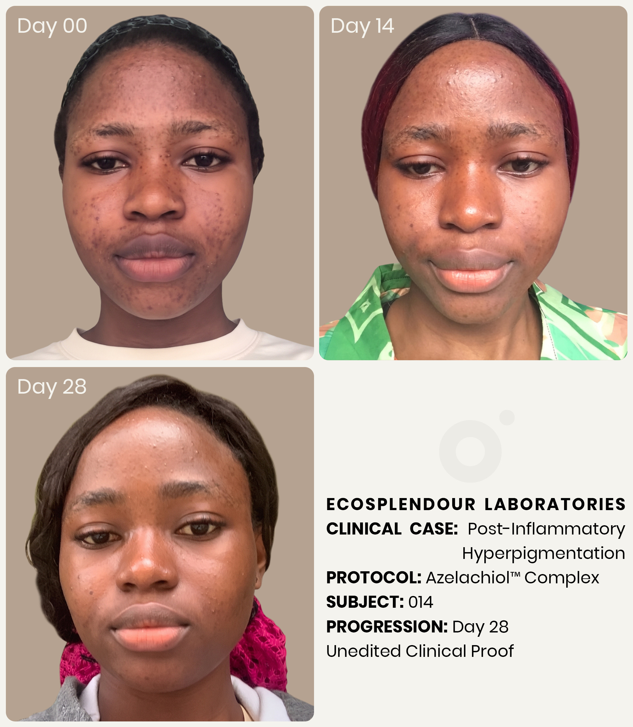 Unedited clinical beta test results N=30 before and after 28 days